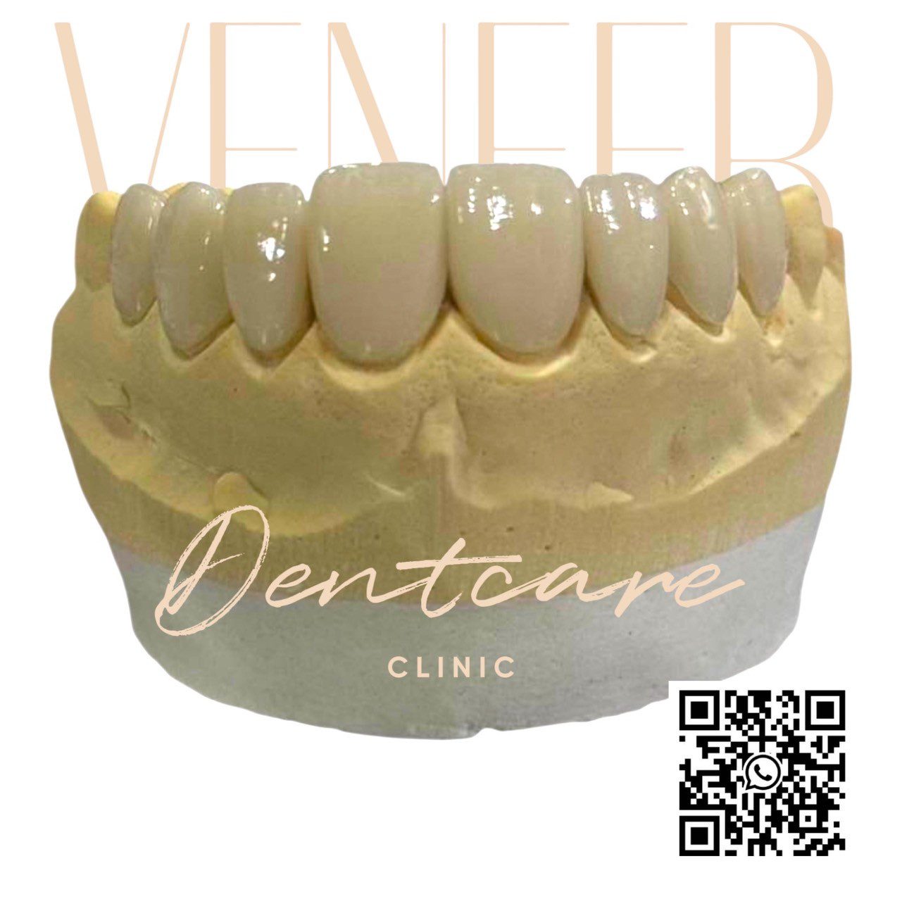 Veneer Dentist Phuket (13)