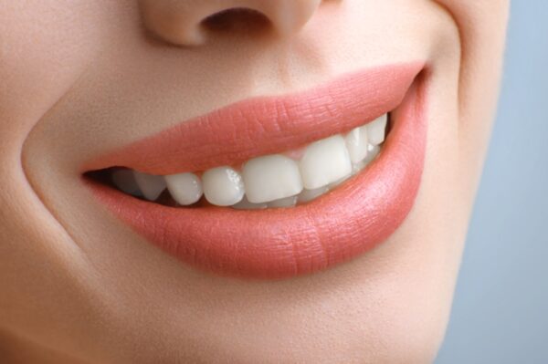 Dentist Phuket Patong. Implants, Crowns, Bridges, and Veneers.